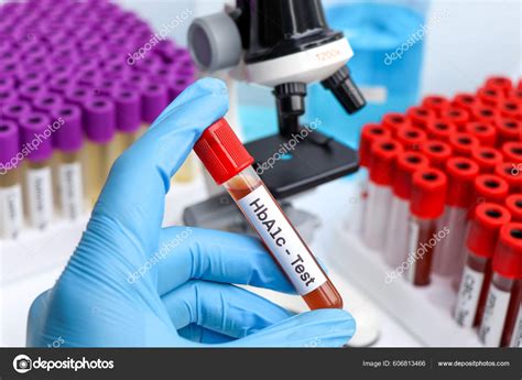 an adult patients blood sample is analyzed in a laboratory|pathophysiology blood test.